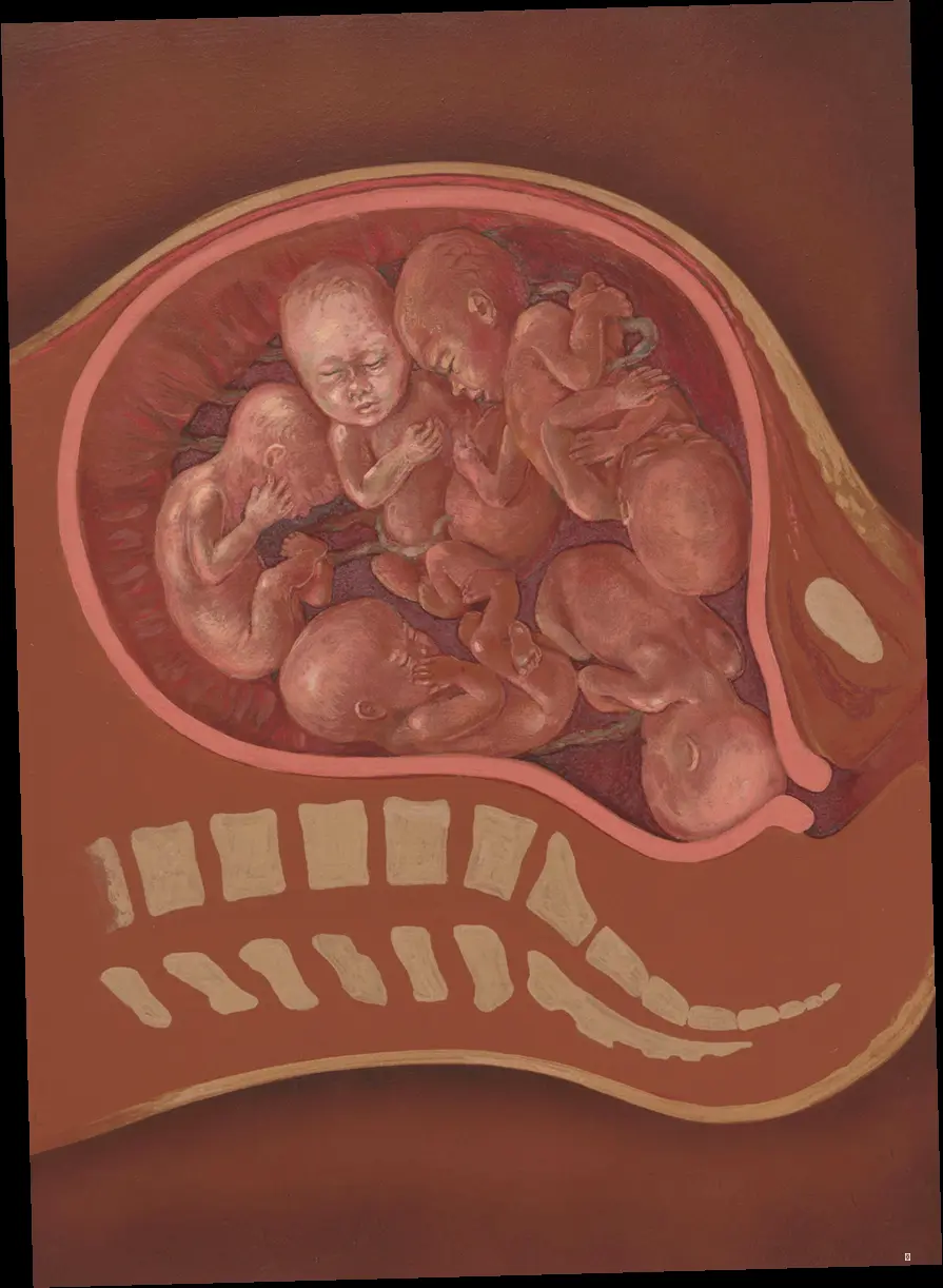 태아 성별, 초음파 정확도 파헤치기